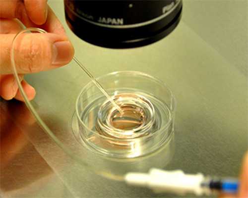 南昌中介借卵生子_S5S9m_WZI87_211N5_8Onpb_瑞白上午打还是下午打好?_0E214