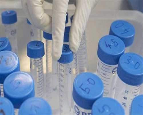 月经期后几天可以查白带