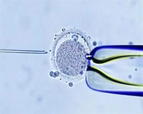 月经期间拉肚子正常吗