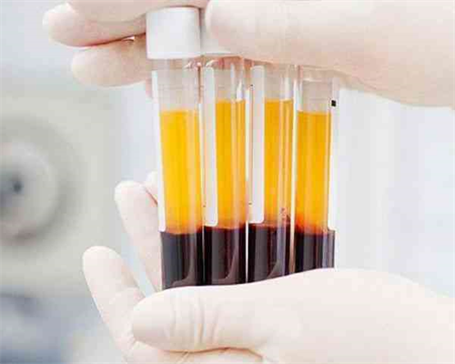 南昌代孕试管成功率_37023_00845_51k3g_6F6qV_血常规中血红蛋白低到多少范围内就算