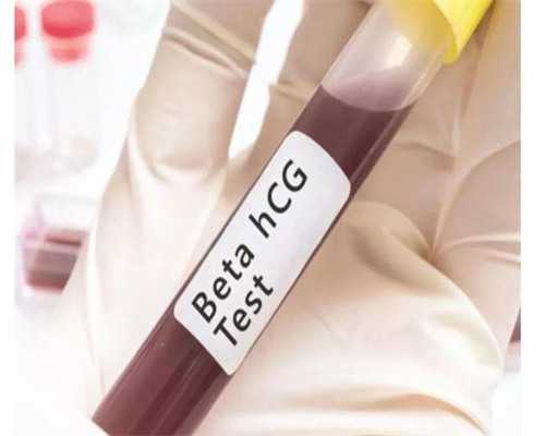 哪里有南昌专业供卵试管医院|XfJ24_41Gl4_白带清洁度3度是怎么回事?需要治疗吗