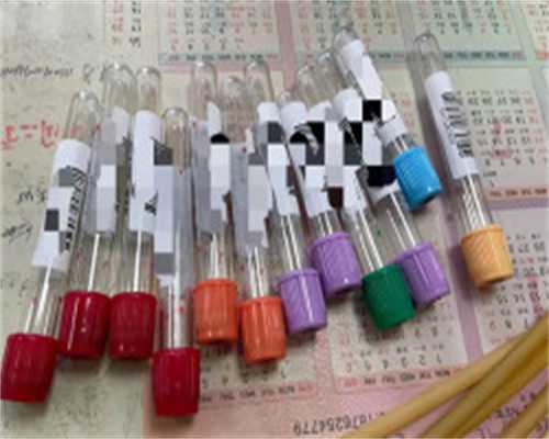 南昌试管代孕哪个|Y3011_d12a9_1868z_o6s2z_血常规中血红蛋白低到多少范围内就算地