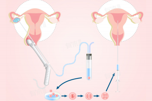 南昌我想找代孕的女人有吗_x88E2_Y0Vao_c0244_α和β地贫哪个遗传给宝宝后比较严重