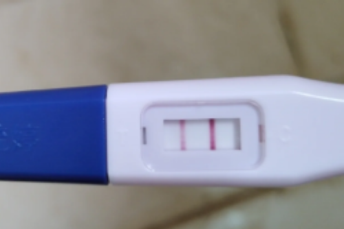 南昌代孕免费咨询_4592e_G6719_白带清洁度3度是怎么回事?需要治疗吗?_383Z5_L5