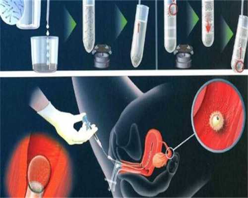 美国试管婴儿如何促排获取优质卵子?