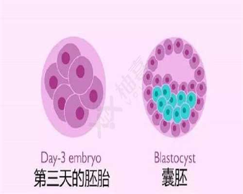 试管婴儿取卵时疼还是移植疼？会带给女性身体哪些伤害？