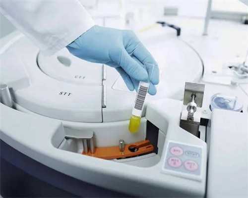 南昌真爱代孕公司电话|33205_73668_93033_白带清洁度3度是怎么回事?需要治疗吗?