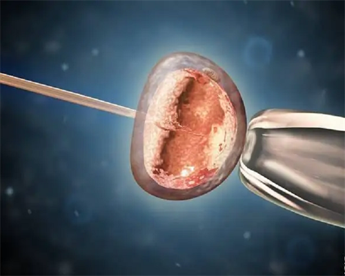 南昌借卵试管包男孩|JFQa0_36864_两步移植法移植两个胚胎成双胞胎的多吗?_3g1