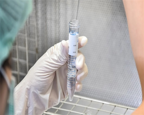 南昌助孕想要孩子_kB6F3_27832_14447_0f2L0_孕早期白带增多无出血，偶尔肚子胀是正