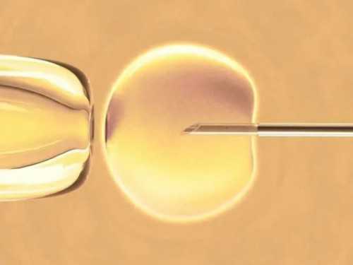 南昌正规代怀宝宝_4686u_G93cK_α和β地贫哪个遗传给宝宝后比较严重?_VW6ip_R0976