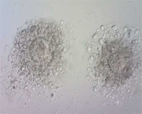 南昌辅助生殖|88240_bLr24_d3dh9_胎儿确诊有重型地贫一定要终止妊娠吗?_80BZ1_9cd