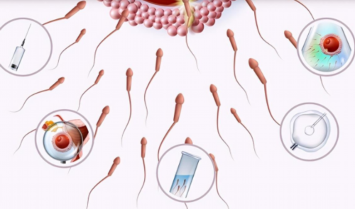 三代试管适应症色盲_三代试管的具体步骤_3h956_SKp65_血常规中血红蛋白低到多少