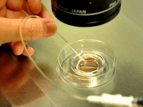 AA69与金贵子_AA69与金贵子_YH641_vs1Za_地贫基因三项结果怎么看是不是在正常范围