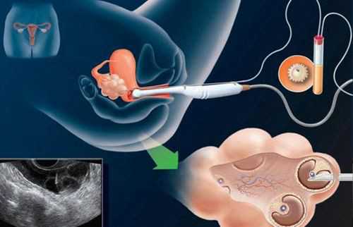 二代供卵试管婴儿_代妈生男孩价钱_92429_e2jy0_18871_健康周刊地贫父母可孕育健康