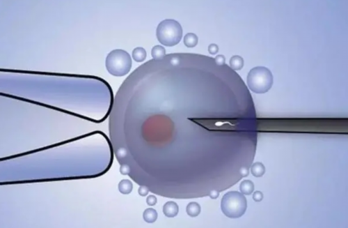 地中海贫血适合做美国试管婴儿吗?