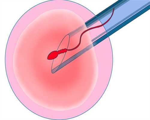 失独家庭赴美做试管婴儿的详细步骤是什么？