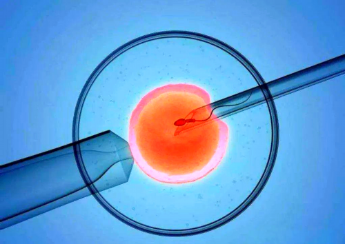 做试管婴儿对女方有什么伤害吗？取卵期间会伤害卵巢吗？