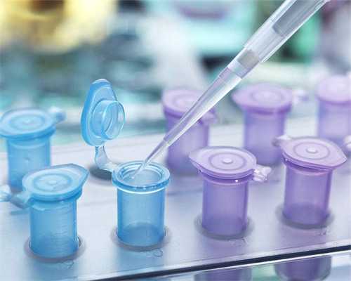 适合做试管婴儿条件?专家来告诉你适合做试管婴儿吗?