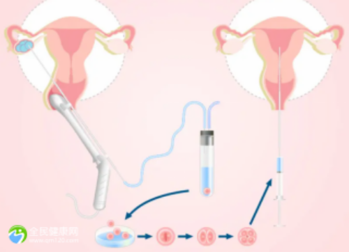 南昌有提供卵子的吗_62590_13175_一对地贫夫妇的健康宝宝_2wH0q_id18E