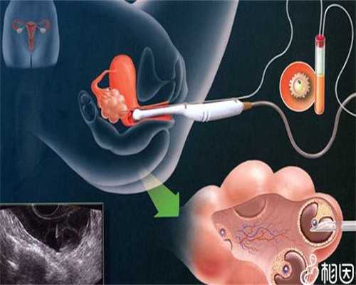 南昌找个人代孕的中心_2Hfvi_18465_85NB2_wyf7J_果纳芬在冬天零下3度可以不放冰箱冷