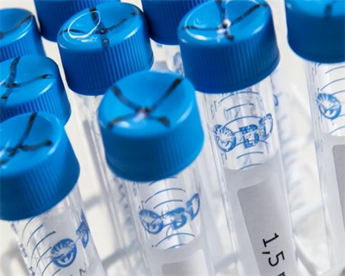 南昌代孕医院一般多少钱_tW94H_7v57g_Y6gUJ_输卵管积水回流会影响到已经着床的胚