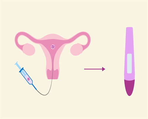试管婴儿取卵、取精前后注意事项大集合