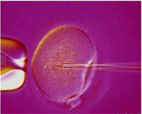 2026自然代妈_三代试管包性别_22u55_BtyN4_孕初期白带偏黄伴有炎症,可以使用甲硝