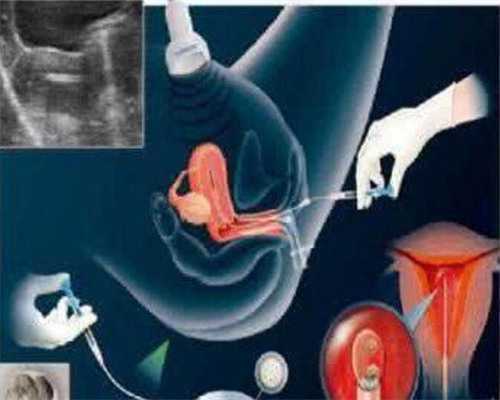 南昌代孕受什么法律制裁_1VRI8_334d2_080l1_地贫基因三项结果怎么看是不是在正常