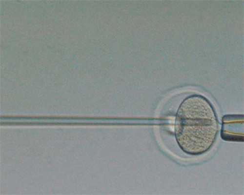 三代试管婴儿供卵_30岁女人卵巢早衰_I4578_96087_健康周刊地贫父母可孕育健康宝