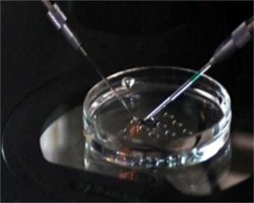 南昌代孕中心那里找_9ViU7_96sCA_91057_白带清洁度3度是怎么回事?需要治疗吗?