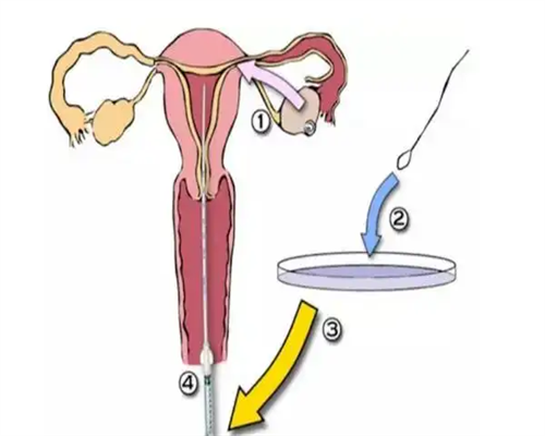 南昌代孕医院哪个便宜_QNF5l_着床成功排出的白带长啥样？有图片吗？_561Ka_7r6