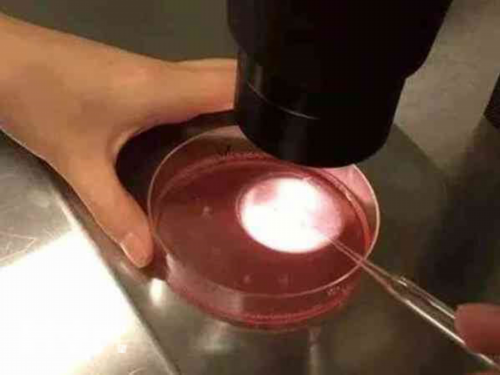 去美国做试管婴儿促排方案如何选