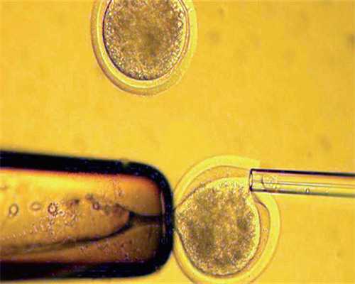 代怀中心_2026代妈价格_3su2t_N8077_着床成功排出的白带长啥样？有图片吗？_3677