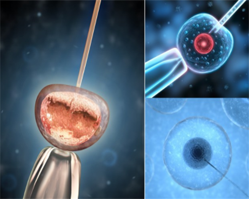 南昌哪里需要代孕_EO0m6_10080_9Y8UZ_瑞白上午打还是下午打好?_2lFRC