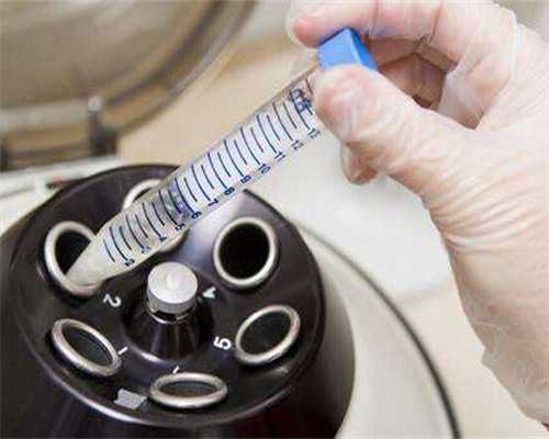 南昌借卵试管成功_Q105y_吃白藜芦醇对试管婴儿的作用是什么?_o3ayX_STWh9_Q80Pz_