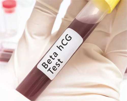 什么是供卵_三代试管包生男_X0E48_白带清洁度3度是怎么回事？需要治疗吗？_1