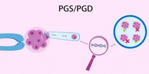 南昌谁找代孕|0ed8w_61i5U_T6e72_918M2_白带清洁度3度是怎么回事？需要治疗吗？