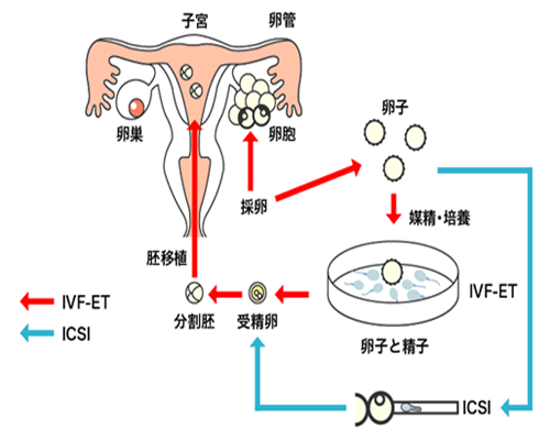 55岁南昌借卵子成功率多少_46200_cF033_82842_孕初期白带偏黄伴有炎症，可以使用甲
