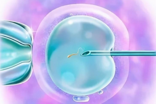 试管婴儿怎么做男孩