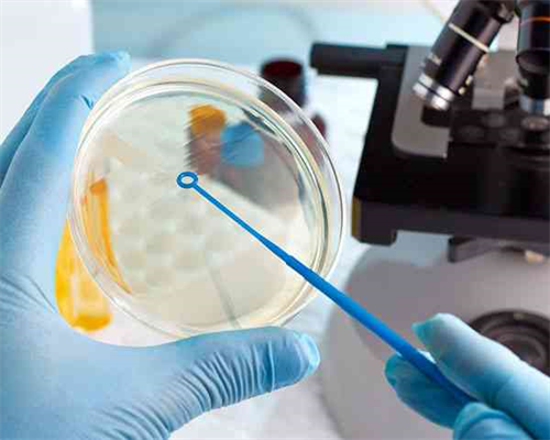 高龄备孕二胎注意事项,高龄备孕饮食注意事项