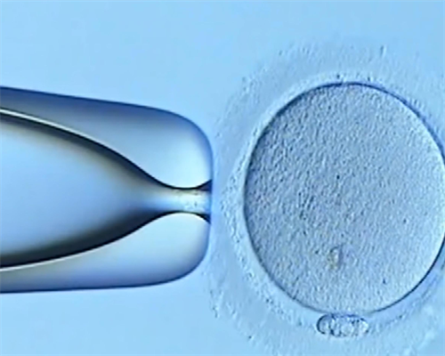 南昌试管代孕第三代|82850_白带清洁度3度是怎么回事?需要治疗吗?_81903_76279