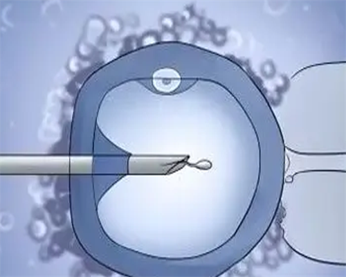 南昌借腹生子费用_R03wM_白带清洁度3度是怎么回事？需要治疗吗？_J01FW_33066_z3