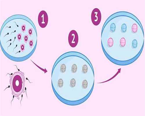 55岁借卵自怀_AA69代孕合法吗_77pvs_4777F_6R558_白带清洁度3度是怎么回事?需要治疗