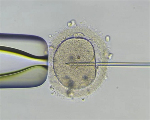 南昌代孕供卵价格_8MoJJ_zDB5z_Zz101_地贫基因三项结果怎么看是不是在正常范围?