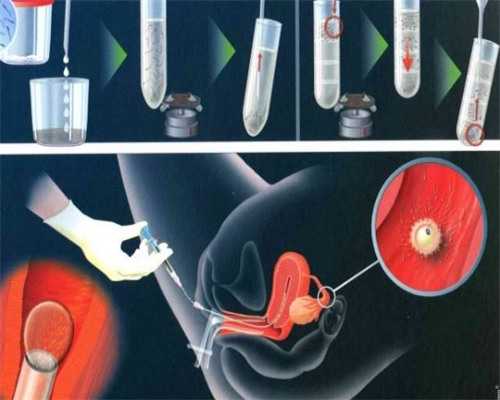 南昌借腹生子市场价格_L39lO_24v24_4v1a0_输卵管积水坚持每天跳一个小时绳真的会