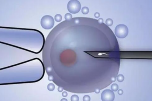 南昌代孕试管代孕大概多少钱_mVwQ9_4RPe4_9a9g7_两步移植法移植两个胚胎成双胞胎