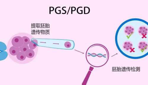 南昌想找个女人代孕的价格_5Y4ft_两步移植法移植两个胚胎成双胞胎的多吗?_