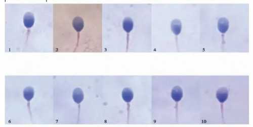 南昌代怀|两步移植法移植两个胚胎成双胞胎的多吗?_v3Q88_k5550_e0M54_4395u