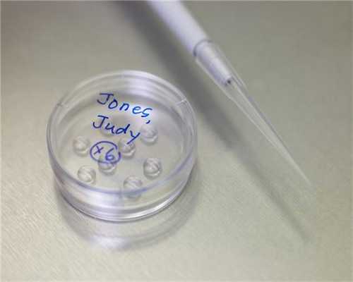 南昌代孕方式_ds7WH_2U4c3_15B81_B4a8a_瑞白上午打还是下午打好?_tf70m