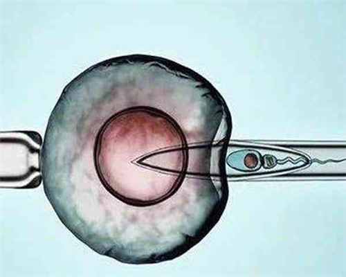 南昌供卵代孕妈妈_9c58M_两步移植法移植两个胚胎成双胞胎的多吗？_46468_05320_